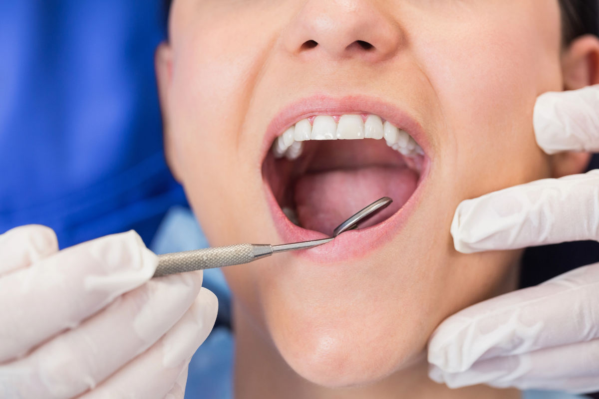 igiene dentale