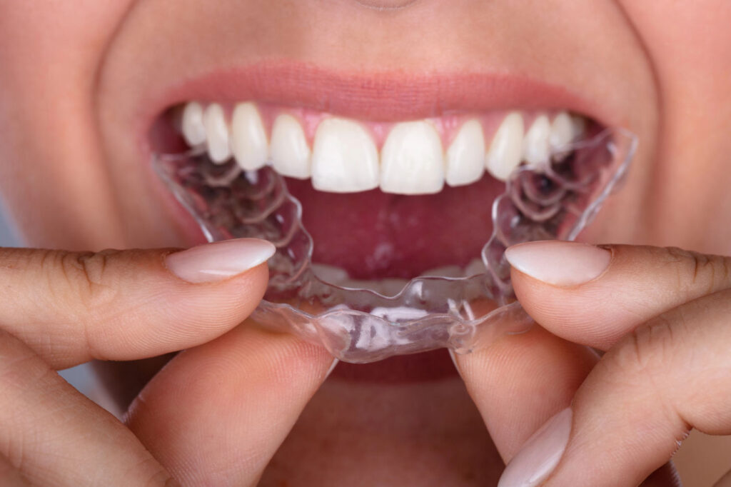 estetica dentale milano monza bergamo