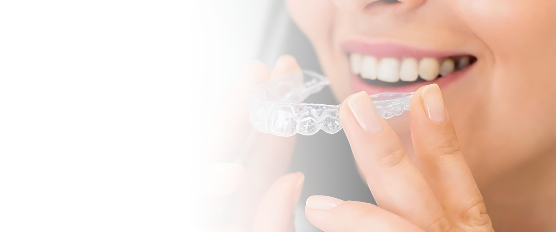 ortodonzia invisibile